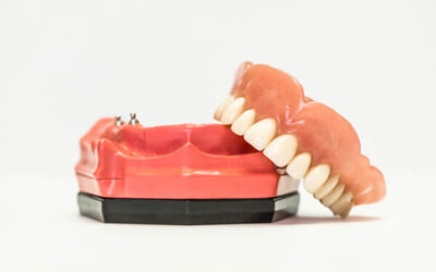 Dentures vs Dental Implants: Which Is the Better Choice?