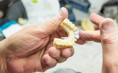 How 3D Printing Is Used In The Dental Implant Industry